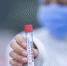 2732 новых случая Covid‑19 выявили в Подмосковье за сутки - KrasnogorskRIAMO.Ru